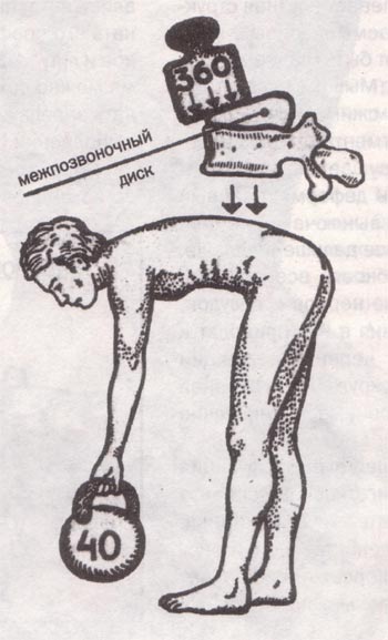 огромная нагрузка на поясничный отдел позвоночника