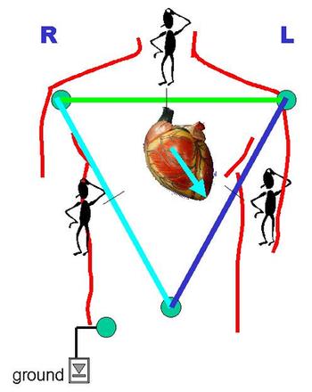 схематическое расположение вектора ЭДС сердца