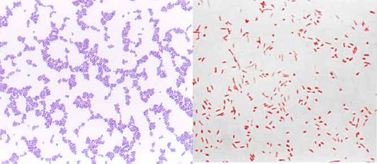 бактерии, окрашенные по Граму