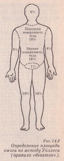 определение площади ожога по правилу девяток