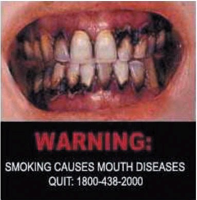 болезни полости рта