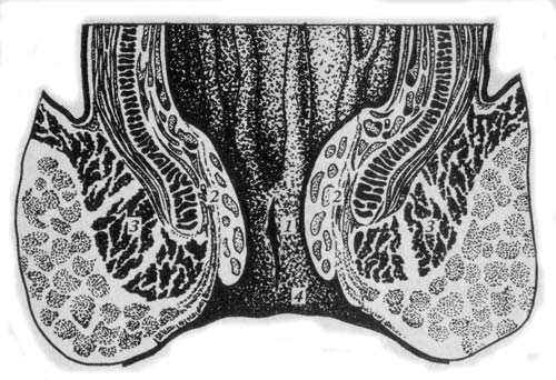 локализация трещин анального канала