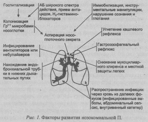 факторы развития нозокомиальной пневмонии