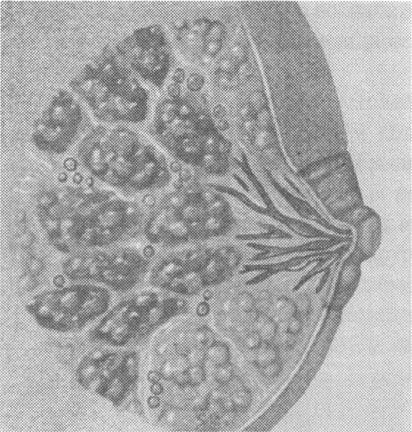 кистозно-фиброзная мастопатия молочной железы