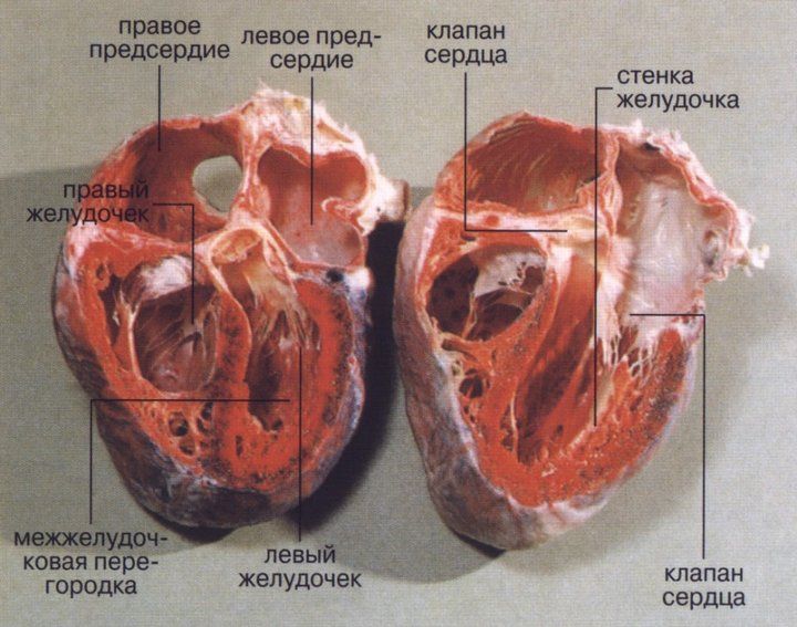 камеры сердца в разрезе, стенки левого желудочка значительно толще правого