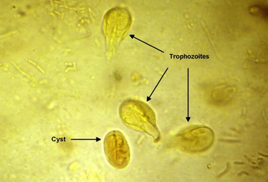 вегетативные формы и цисты лямблий под микроскопом