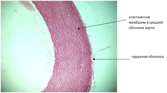 эластические волокна в аорте при окраске орсеином