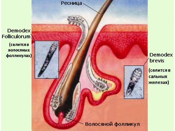 угревой клещ Демодекс в коже