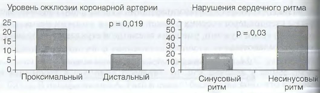 число случаев внезапной смерти при инфаркте миокарда в зависимости от места закупорки коронарной артерии и наличия аритмий при госпитализации