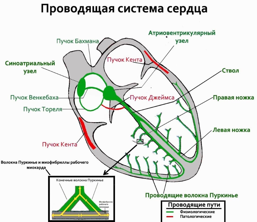 нормальные и патологические пучки проводящей системы сердца