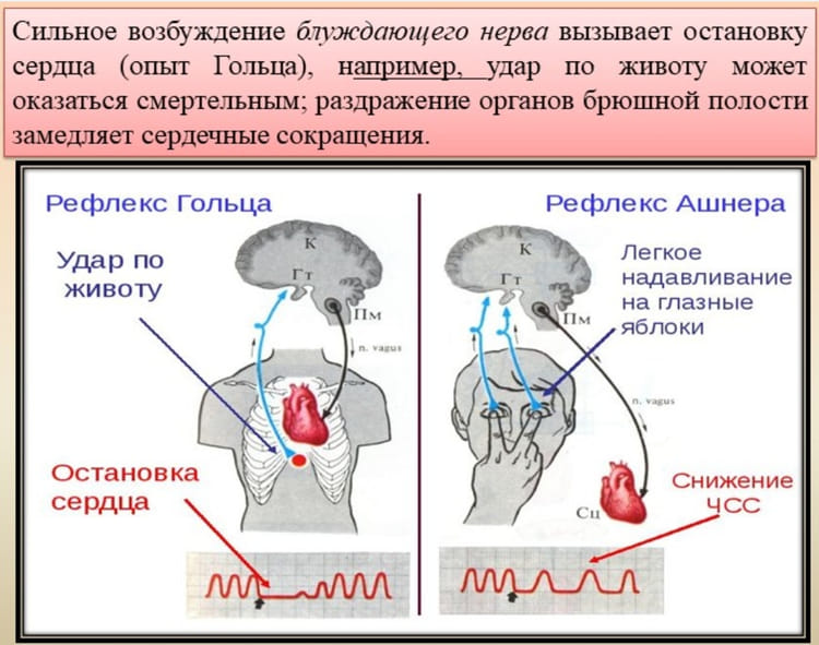 раздражение блуждающего нерва может вызвать остановку сердца