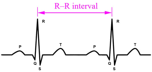 интервал RR на ЭКГ