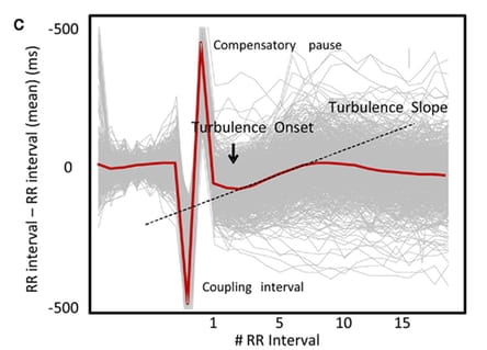 Фазы турбулентности ритма сердца: turbulence onset (начало турбулентности), turbulence slope (наклон турбулентности)