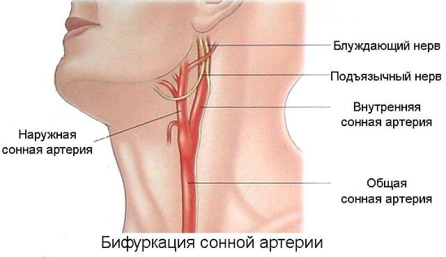 где находится бифуркация сонной артерии