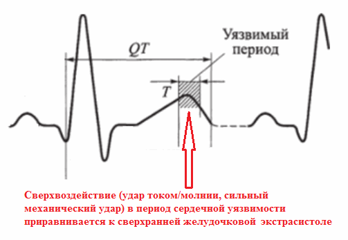 уязвимый период сердечного цикла на ЭКГ