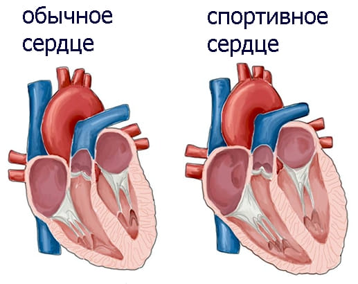 спортивное сердце по сравнению с обычным (нетренированным) сердцем