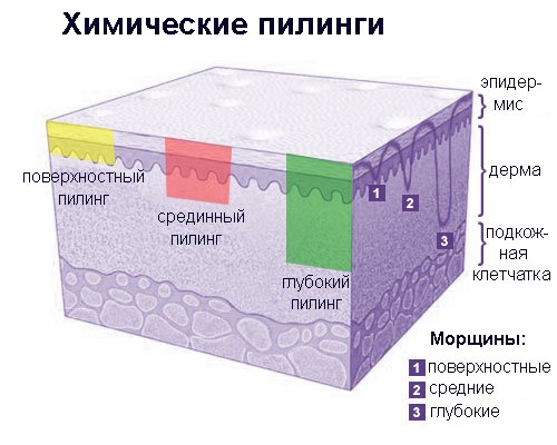 глубина химических пилингов по сравнению с глубиной морщин