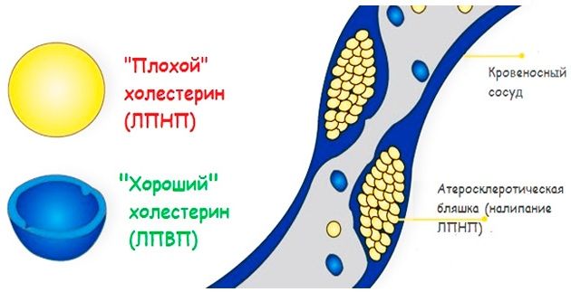 плохой холестерин накапливается в стенке артерий