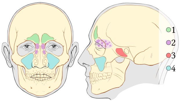 виды придаточных пазух носа и синуситов в черепе